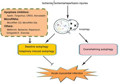 The Role of Autophagy in Acute Myocardial Infarction